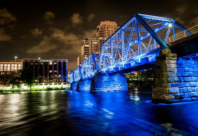 can you break the bridge of your foot_3